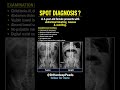 🩻 DIAGNOSIS | Pediatrics MCQ | Acute Abdomen in Pediatrics | Spot Diagnosis X-ray Quiz|#neetpg #xray