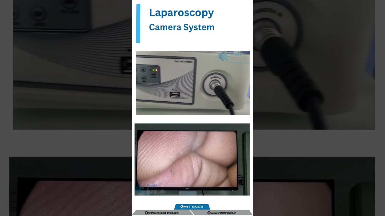 Laparoscopy Camera System