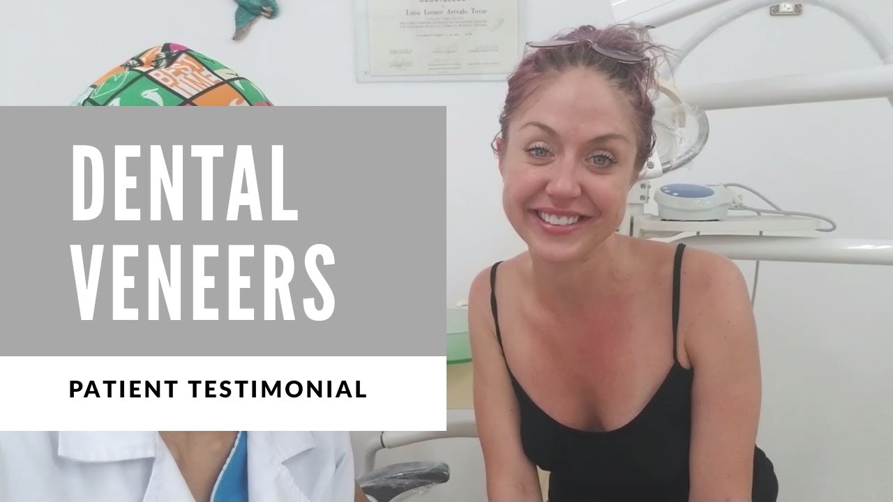 Affordable Dental Veneers! In Colombia YouTube