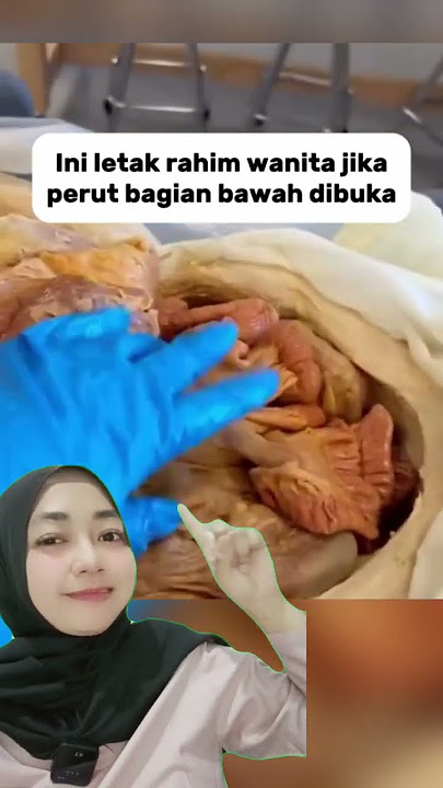 letak rahim perempuan #janin #love #rahim