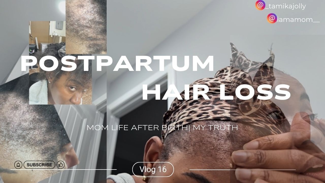 Postpartum Hair Loss Is Real 😩 | My Experience, What I Learned & Encouragement for Moms
