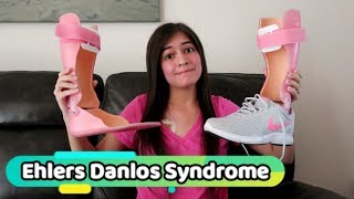 ? Ehlers Danlos Syndrome | Diagnosis Discussion ⚕?