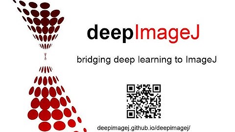 Install a deepImageJ model form the BioImage Model Zoo
