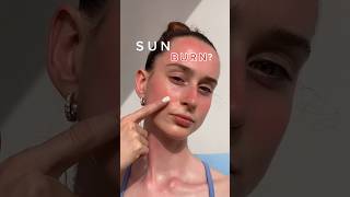 Sunburn? 🥵🔥Try these Aloe Vera Ice Cubes 🌵🧊💦 #shorts #sunburn #lifehack
