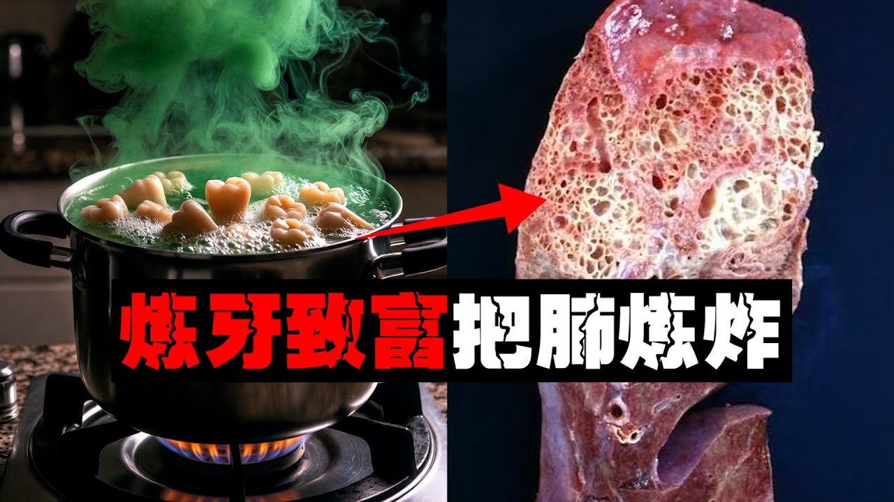 【炼牙暴毙】男子为致富长期烹煮烂牙，这是他肺部发生的变化。。。