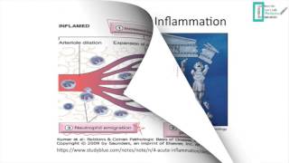 Acute Inflammation - Part 1