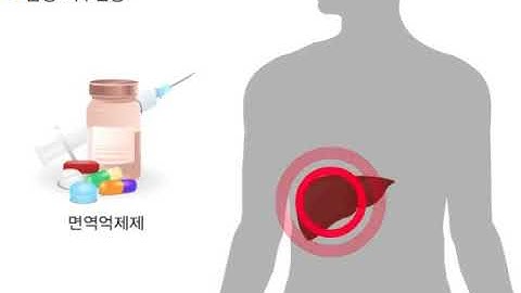 거부반응의 종류