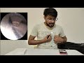 Viral Productwireless Viuaal earpick (ear cleaner)