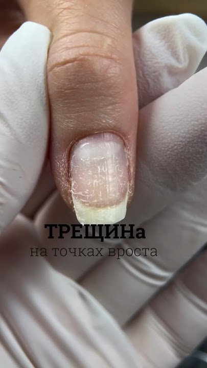 Укрепление гелем желе #nails #гель желе #ремонт ногтей - YouTube