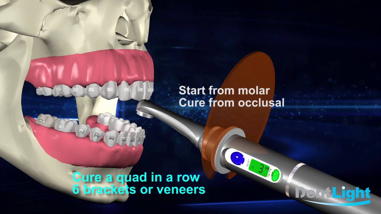 Dental Curing Light - Sapphire Plus Plasma-Arc Curing Light