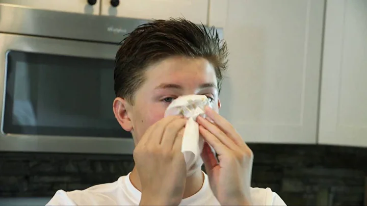 What Causes Nosebleeds - DayDayNews