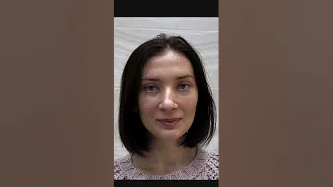 ПЛАСТИЧЕСКАЯ ОПЕРАЦИЯ ДО И ПОСЛЕ