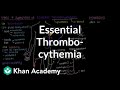Understanding Essential Thrombocythemia