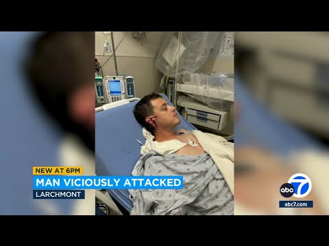 Larchmont man's ear sliced off in violent attack outside his home