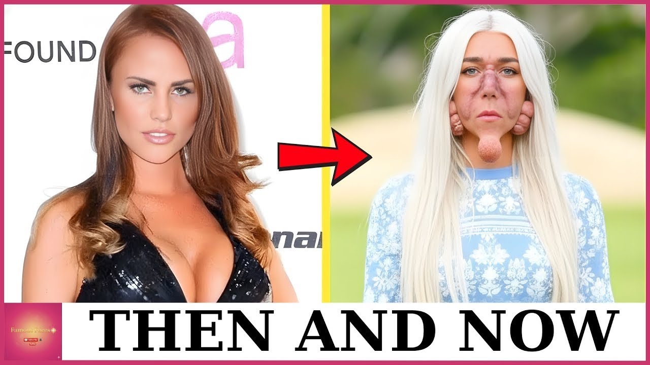 Live: 10 Plastic Surgery Nightmares That Ruined Hollywood Stars’ Careers | Then and Now 2026