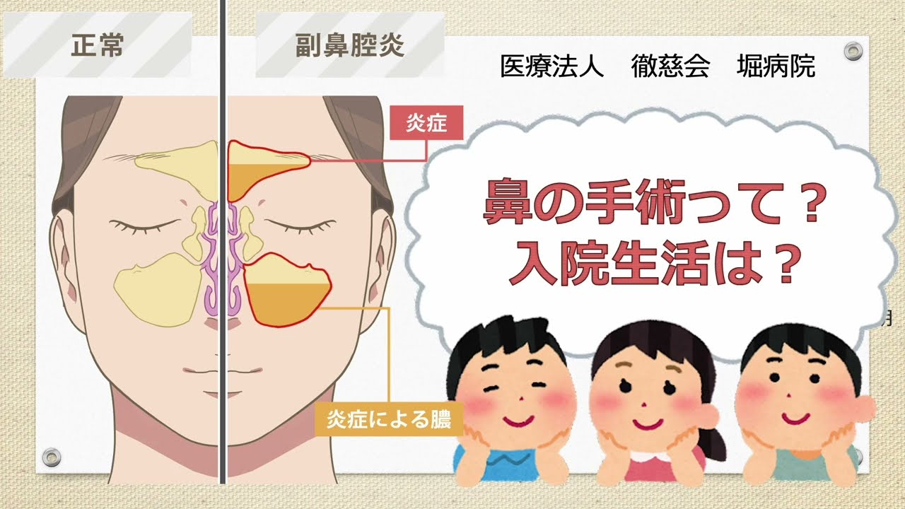 【堀病院病棟】鼻の手術って？入院生活は？