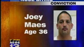 Clovis man faces 13 years for nose biting