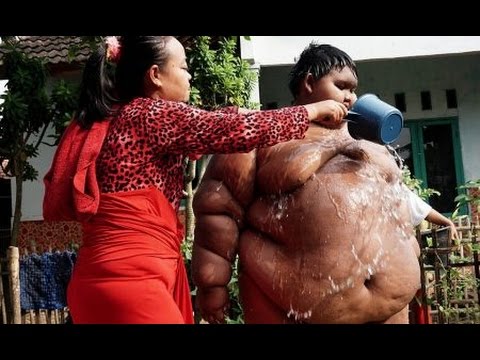 Retractio Penis