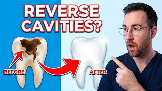 Famous Reverse Cavities at Home? Here's What Actually Works Wealth