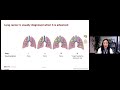 Lung Cancer in Asian Americans: Screening, Treatment, and Advancements