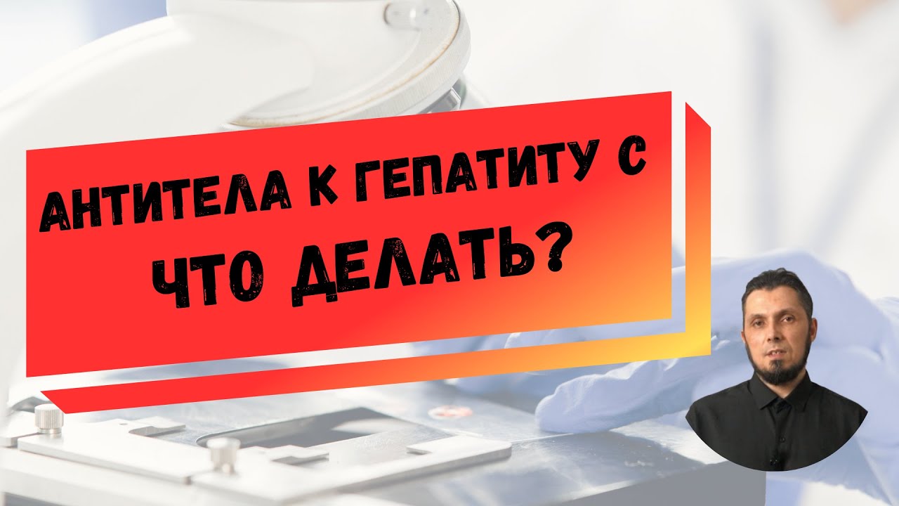 Обнаружены антитела к вирусу гепатита С - что делать?