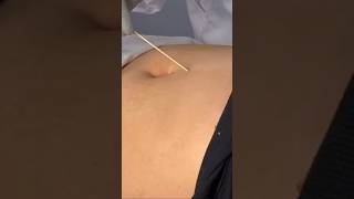 ASMR Belly Button Exam  #asmrtingles #bellybutton #unintentionalasmr #asmrmedical #asmrsoftspoken