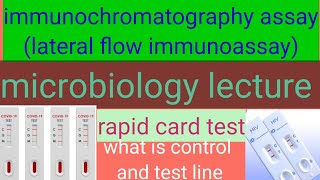 immunochromatography assay (lateral flow immunoassay ) / rapid immunoassay test