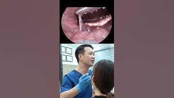 Hóc Xương.cá - Giờ thứ 1 | Bác sĩ Hiệu Long Biên