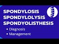 What is Spondylosis? Spondylolysis Spondyolisthesis  Diagnosis & Management