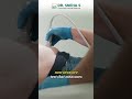 Fibroscan Advanced Technology for Liver care