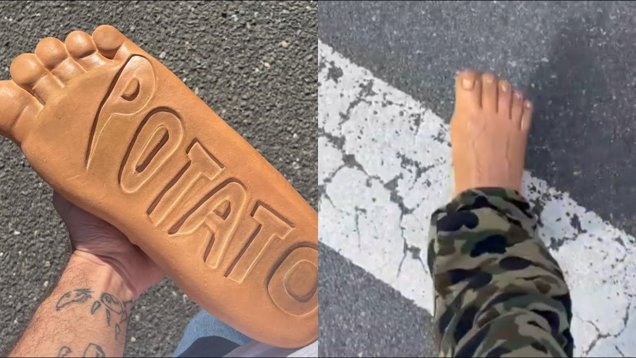 Imran Potato Steps Out In Brand New Foot Shoe 