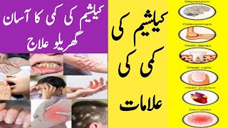 Calcium Deficiency Treatment In Urdu/ Calcium Ki Kami Ki Alamat Aur ilaj/Calcium Deficiency Symptoms
