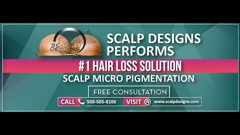 Ink your Confidence with Scalp micropigmentation at Scalp Designs