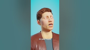 Why Welders Need Eye Protection 😮