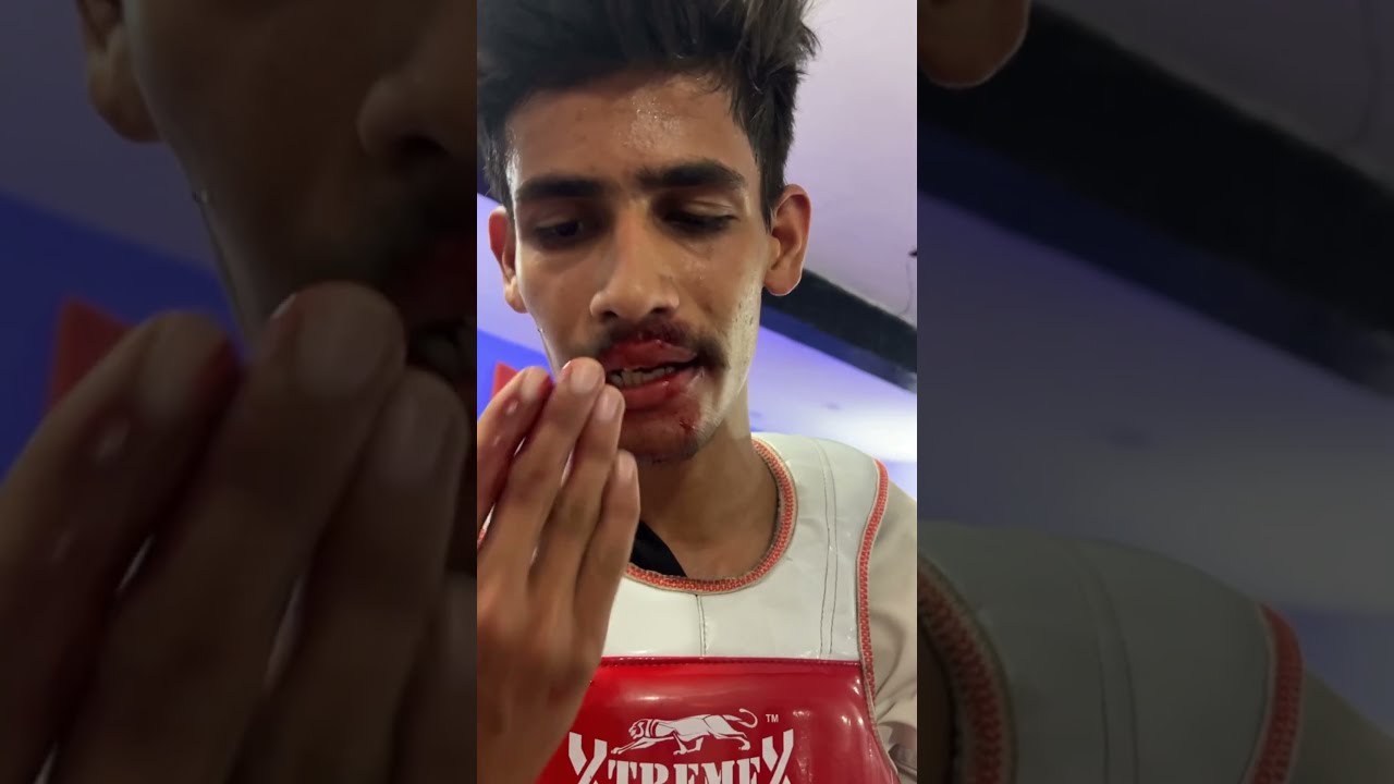 Priyanshu Got Injured Before Championship Taekwondofight Taekwondo Fight Shorts