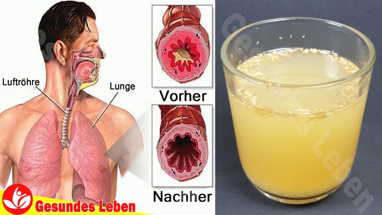 Ist Es Ungesund Den Hustenschleim Zu Schlucken Schleim Aus Der Lunge Reinigen Und Mit Diesem Getränk Die Immunität