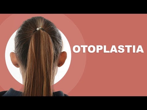 Otoplastie 👂 caz inainte si dupa 👉 evolutia pas cu pas din prima zi pana la 9 luni