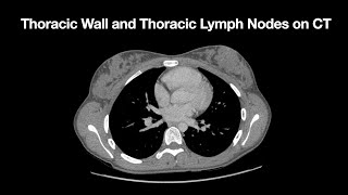 Anatomy of the Thoracic Wall and Thoracic Lymph Node Stations on CT Ct Assessment Exercise On Thoracic Lymph Node Stations