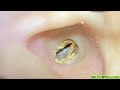 ASMR：🌙深夜だけに聞こえる耳の音
