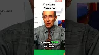 Пиявки польза