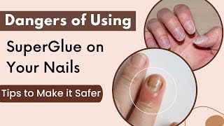 Risks Of Using Super Glue on Your Nails- Tips to Make it Safer