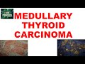 MEDULLARY THYROID CARCINOMA : Gross, Microscopic &amp; Clinical features