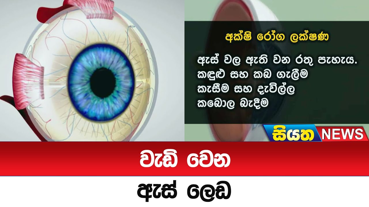 වැඩි වෙන ඇස් ලෙඩ | Siyatha News