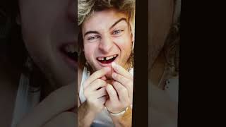 A fake tooth prank￼