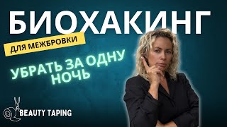 Проблема -Межбровка? Тейпирование Решит за Одну Ночь!