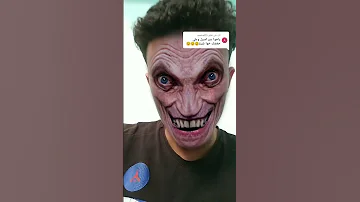 عمي الغول يحتاج منكم الدعم 