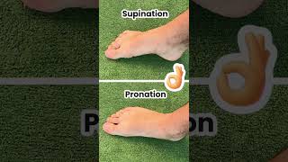 Fix Your Bunions &amp; Overpronation at The Same Time