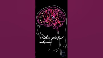 Why You Remember Embarrassing Moments So Clearly 😳 | Psychological Facts #shorts