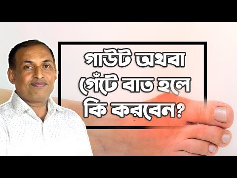 গাউট বা গেঁটে বাত হলে কি করবেন? গাউটের আকুপ্রেসার। What to do if you have arthritis? by Alamgir Alam