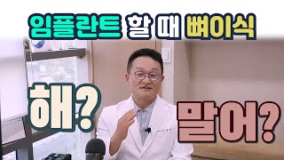 뼈이식 임플란트 해야 하나?! 말아야 하나?!~ #임플란트 #뼈이식임플란트 #임플란트뼈이식